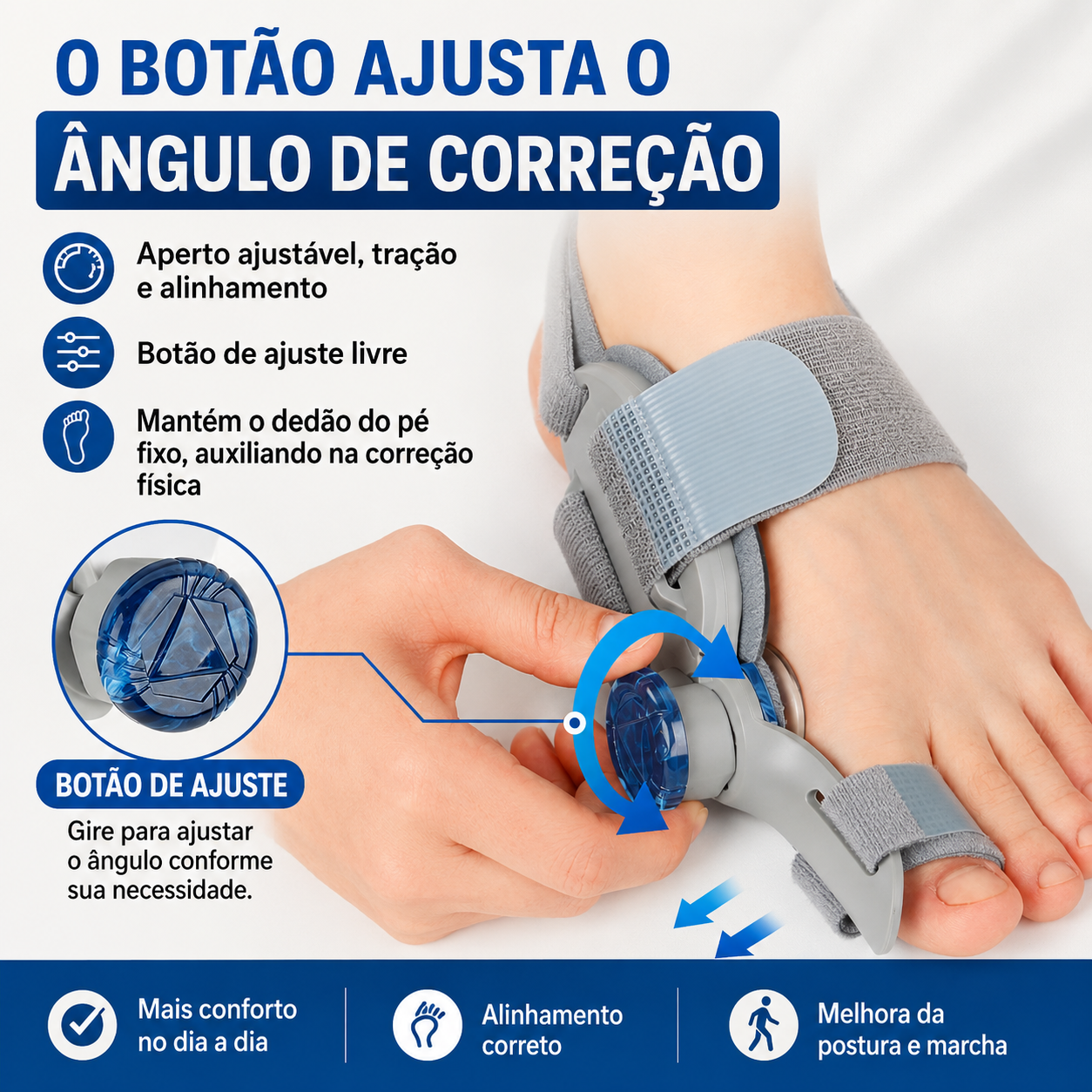 Corretor Ortopédico para joanete - Resultado em 2 semanas