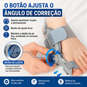 Corretor Ortopédico para joanete - Resultado em 2 semanas